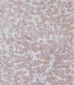 UGT2B15 Antibody (Center)